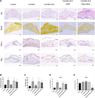 Icariin Alleviates Wear Particle-Induced Periprosthetic Osteolysis via Down-Regulation of the Estrogen Receptor α-mediated NF-κB Signaling Pathway in Macrophages